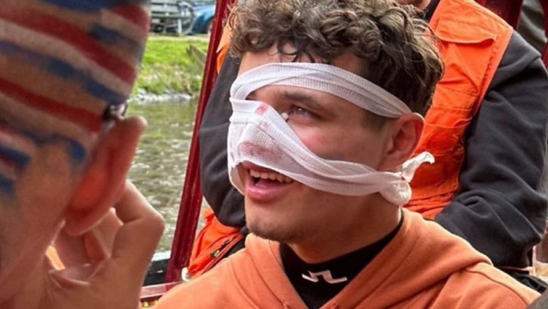 F1 - O Νόρις «έσπασε» τα μούτρα του σε πάρτι στην Ολλανδία (vid)