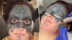 Τη νάρκωσαν και της έκαναν τατουάζ σε όλο της το πρόσωπο: Δέκα χρόνια μετά ο εφιάλτης της τελειώνει (vid)