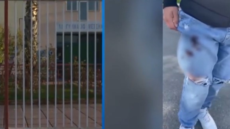 Ένας 14χρονος στη Μεσσήνη μαχαίρωσε συμμαθητή του με σουγιά (vid)