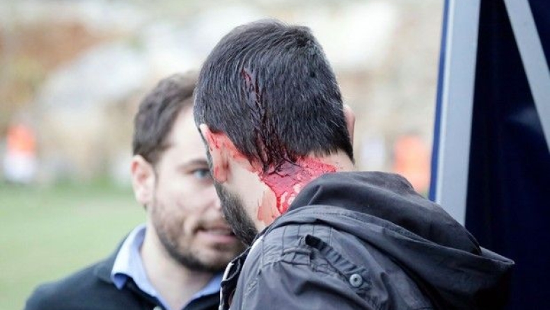 Σοβαρά επεισόδια με τραυματία στη Μαγούλα (pics)