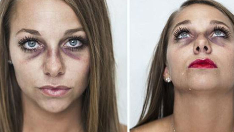 Το πρόσωπο της βίας: Η 27χρονη έγινε viral (pics)