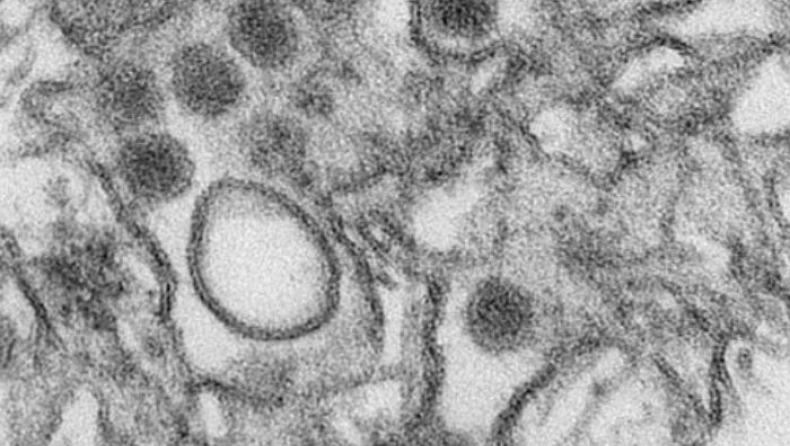 Συναγερμός στην Ευρώπη για τον ιό Ζίκα