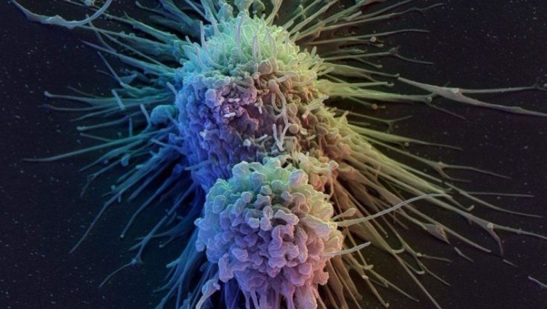 Δοκιμές σε νέα στρατηγική ελέγχου του καρκίνου