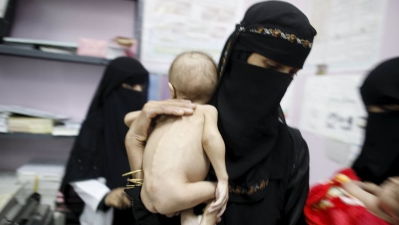 Σοκάρουν οι εικόνες από υποσιτισμένα παιδιά στην Υεμένη (vid)