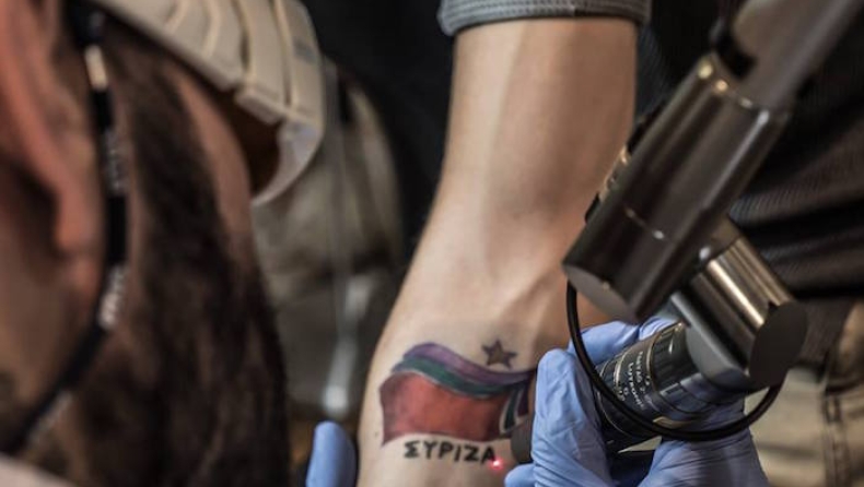 Κάποιος αλήθεια είχε κάνει τατουάζ ΣΥΡΙΖΑ και πήγε να του το σβήσουν (pics)