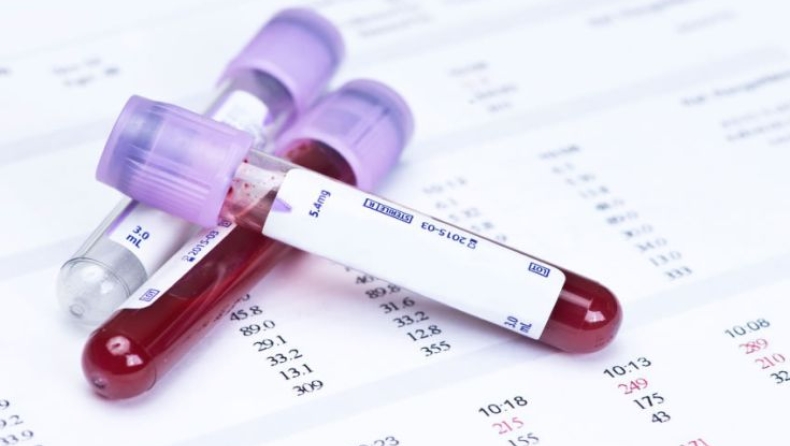 Το πρώτο τεστ αίματος για HIV σε… στικάκι USB