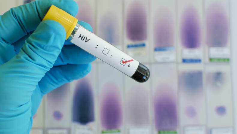 Νέο εμβόλιο κατά του Aids: Θα είναι το τελειωτικό χτύπημα;