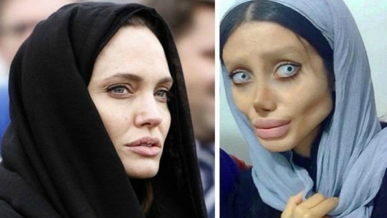 Ιρανή έκανε 50 πλαστικές κι έχασε 40 κιλά για να μοιάσει στην Αντζελίνα Τζολί (pics)