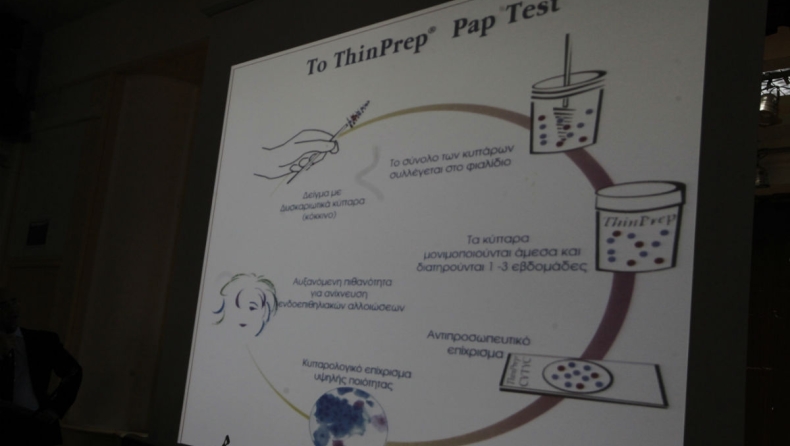 Μόνο το 35% των Ελληνίδων υποβάλλεται τακτικά σε τεστ Παπ