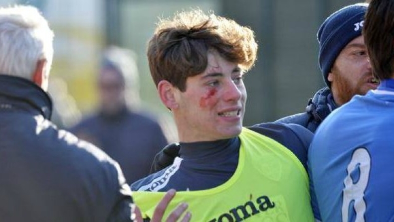 Οπαδοί της Φιορεντίνα χτύπησαν με πέτρα 18χρονο παίκτη της Έμπολι!