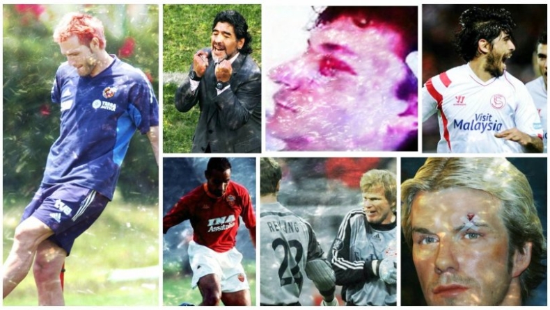 Οι πιο γελοίοι τραυματισμοί ποδοσφαιριστών! (pics)