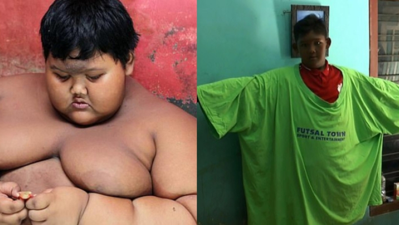 O υπέρβαρος 12χρονος από την Ινδονησία έχασε 90 κιλά σε ένα χρόνο και θέλει να γίνει ποδοσφαιριστής (pics & vid)