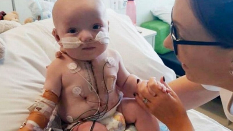 Μωρό «θαύμα» διαψεύδει τους γιατρούς και επιβιώνει με μισή καρδιά (pics)