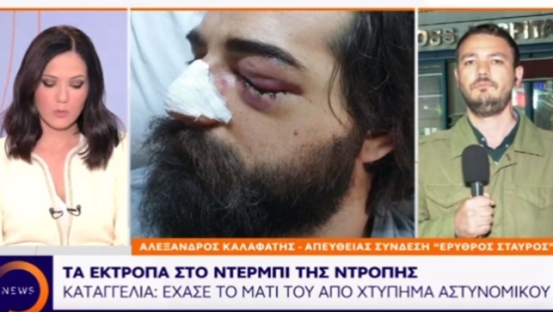 Φίλαθλος του Παναθηναϊκού έχασε το μάτι του από χτύπημα αστυνομικού στα επεισόδια του ΟΑΚΑ (vid)