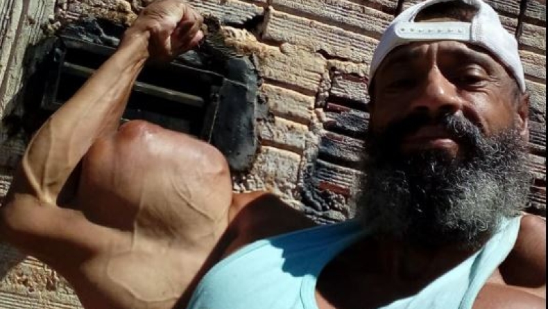 Απίστευτη μεταμόρφωση: Έτσι ήταν ο Βραζιλιάνος Hulk πριν γίνει bodybuilder (pics)