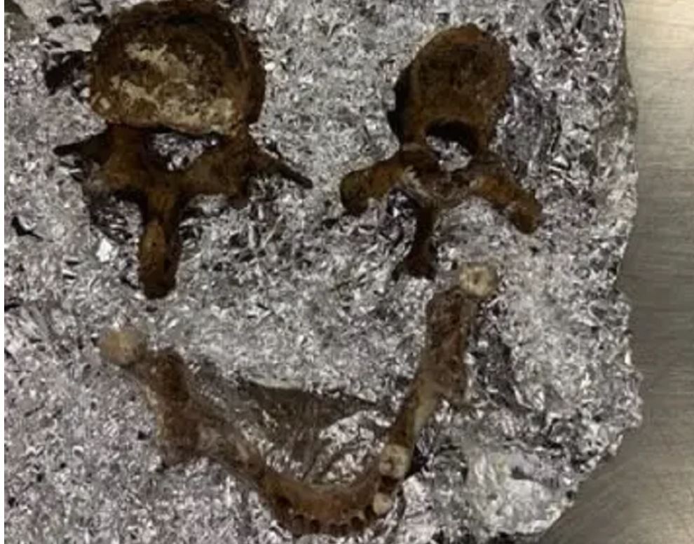 Τα κόκκαλα τυλιγμένα σε αλουμίνιο