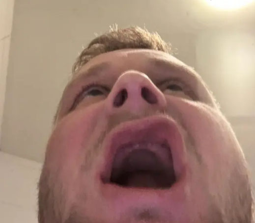 Εχασε τα δόντια του