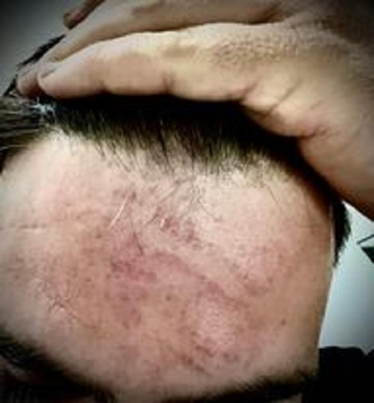 αστυνομικός ξύλο