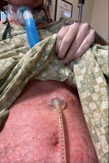 Το σώμα της Ρότζερς μετά την κατανάλωση της ιβουπροφαίνης