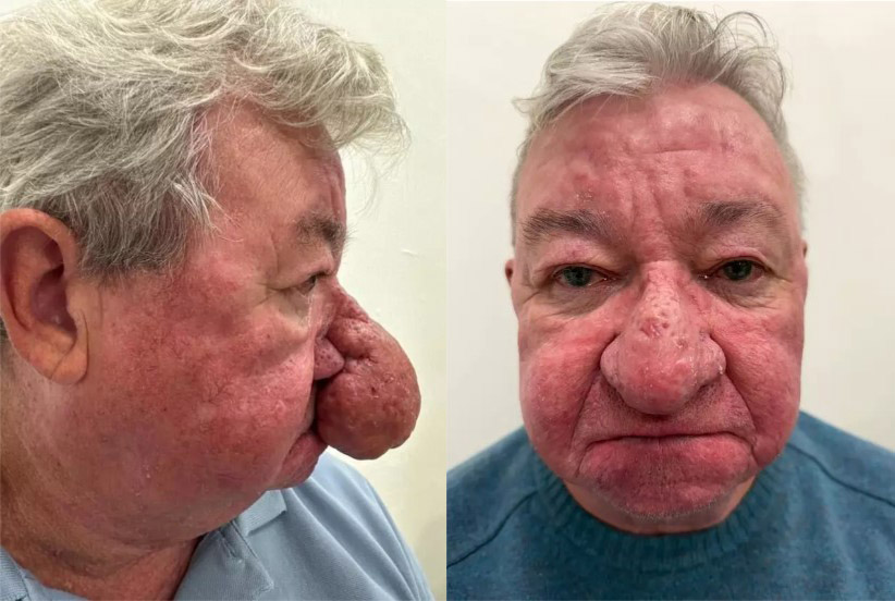 Πριν και μετά την επέμβαση