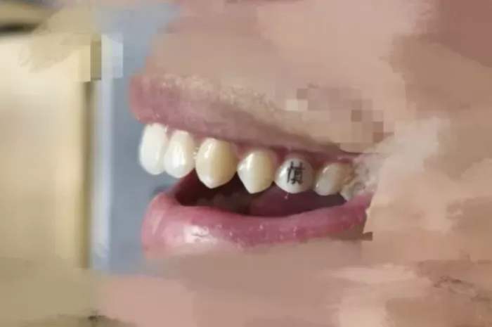 Τατουάζ στα δόντια