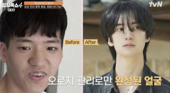 Το πριν και το μετά