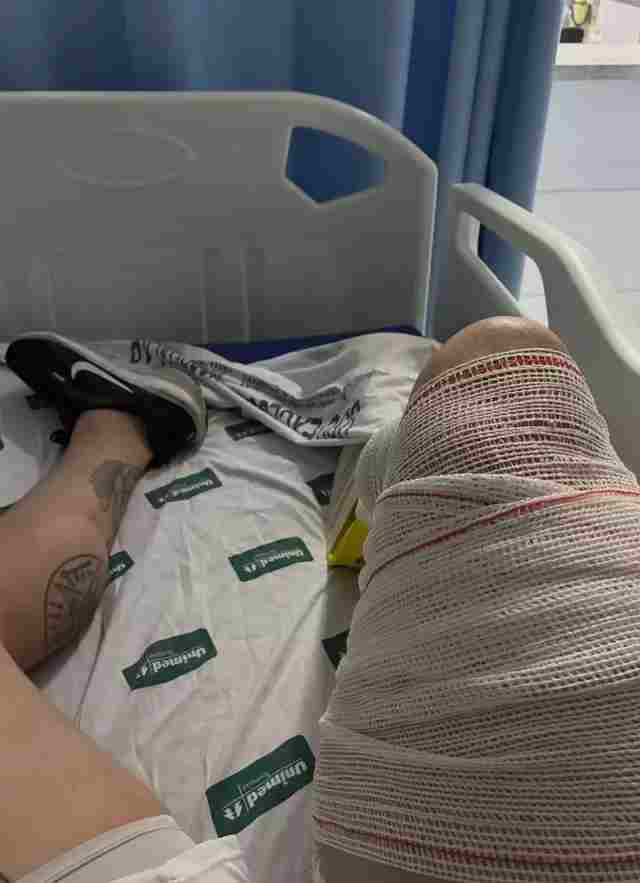 bodybuilder-travmatismos