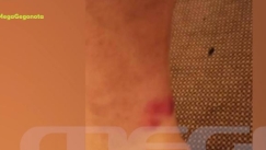 Αποκαλυπτικές φωτογραφίες από τις καμπίνες στο «Euroferry Olympia»: Τους «τρώνε» οι κοριοί, λασπόνερο από τη βρύση (vid)