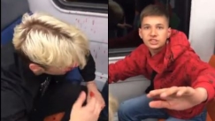 Τρομακτικό βίντεο από τη Μόσχα: Φασίστας χτυπάει άγρια νεαρό που έχει σκουλαρίκι στη μύτη, έτρεμε ο φίλος του από τον φόβο του (vid)