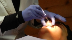 Δύο οδοντίατροι στη Γαλλία καταδικάστηκαν επειδή παραμόρφωσαν εκατοντάδες ασθενείς τους