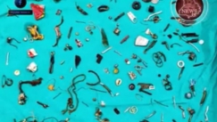 Πήγε στο νοσοκομείο με πόνους στο στομάχι και οι γιατροί του αφαίρεσαν βίδες, ακουστικά, μενταγιόν και παξιμάδια (vid)