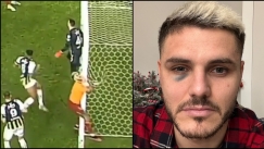 Icardi