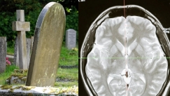 Οι άνθρωποι φρίκαραν με την περίεργη διαδικασία που συμβαίνει στο μυαλό μας όταν πεθαίνουμε