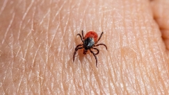 Τα συμπτώματα της νόσου Lyme από την οποία αποκάλυψε ότι πάσχει ο Τζάστιν Τίμπερλεϊκ