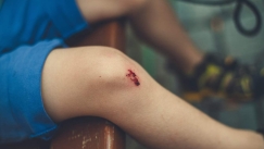 Η επιστημονική εξήγηση πίσω από το «μαγικό» χάδι μετά από κάθε τραυματισμό που περνούσε ο πόνος 