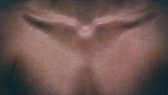 Ανακαλύφθηκε νέο όργανο στο ανθρώπινο σώμα: Τι αλλάζει στην ιατρική (vid)