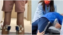 16χρονος Κινέζος ψήλωσε κατά 1,4 εκ. με «θαυματουργή» θεραπεία και επανήλθε στο ύψος του μετά από 2 εβδομάδες