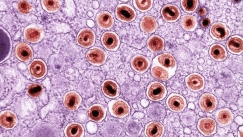 Hib: Η πιο θανατηφόρα ασθένεια για την οποία ίσως δεν έχετε ακούσει ποτέ (vid) 