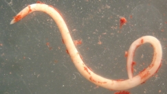 Τι είναι το παράσιτο Anisakis από το οποίο δηλητηριάστηκε ο 22χρονος που έφαγε σούσι (vid)