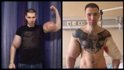 Ο «Ρώσος Ποπάι» κινδυνεύει να χάσει και τα δύο του χέρια μετά τις ενέσεις βαζελίνης που έκανε για να τα φουσκώσει (vid)