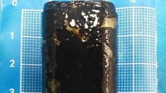 Κατάπιε αναπτήρα σε challenge του '90: Τον βρήκαν στο στομάχι του 30 χρόνια μετά και λειτουργούσε