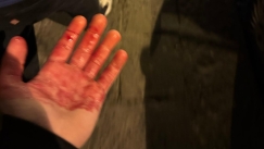 ΤΣΕΛΣΙ ΟΠΑΔΟΣ