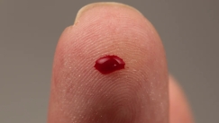 Μια σταγόνα αίματος κρύβει 250 εκατ. κύτταρα: Ο αθέατος μηχανισμός που μας κρατά ζωντανούς