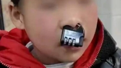 Κίνα: Αγόρι σφήνωσε λουκέτο στη μύτη του και χρειάστηκε επέμβαση πυροσβεστών για την αφαίρεση (vid)