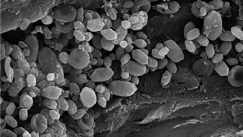 Οι πέτρες στο αυτί μας ρυθμίζουν την ισορροπία: Τι είναι η ωτοκονία