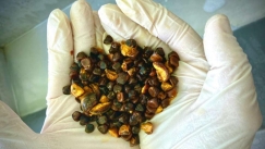 Πιο ακριβές από χρυσό: Πέτρες στη χολή βοοειδών έχουν γίνει το πιο πολύτιμο εμπόρευμα παγκοσμίως (vid)