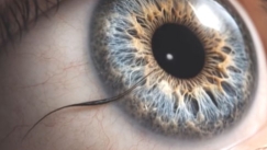 Γιατί μια μικροσκοπική βλεφαρίδα μπορεί να γίνει τόσο επώδυνη