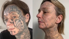 Το σώμα της έγινε «καμβάς» κακοποίησης: Γυναίκα παλεύει να σβήσει 250 τατουάζ που της χάραξε ο σύντροφός της (vid)