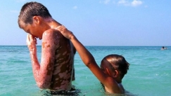 Τα 23.000 παιδιά του Τσερνόμπιλ που βρήκαν θεραπεία στην Κούβα: Η άγνωστη ανθρωπιστική αποστολή