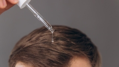 Μεταμόσχευση μαλλιών FUE vs FUT: Οι διαφορές που καθορίζουν το αποτέλεσμα